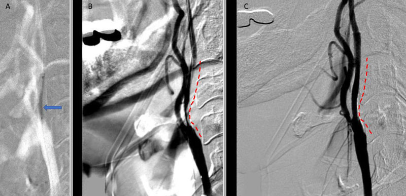 ENCYCLOPAEDIA of OCCLUSION【裁断済】 ENCYCLOPAEDIA of OCCLUSION【裁断済】